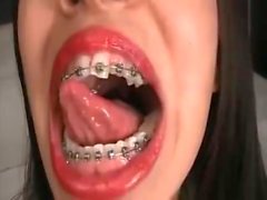 Brunnette big mouth & braces (vore)